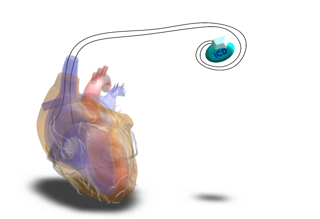 SCT Ceramics Leverages the 3DEXPERIENCE Platform to Streamline Manufacturing Workflow