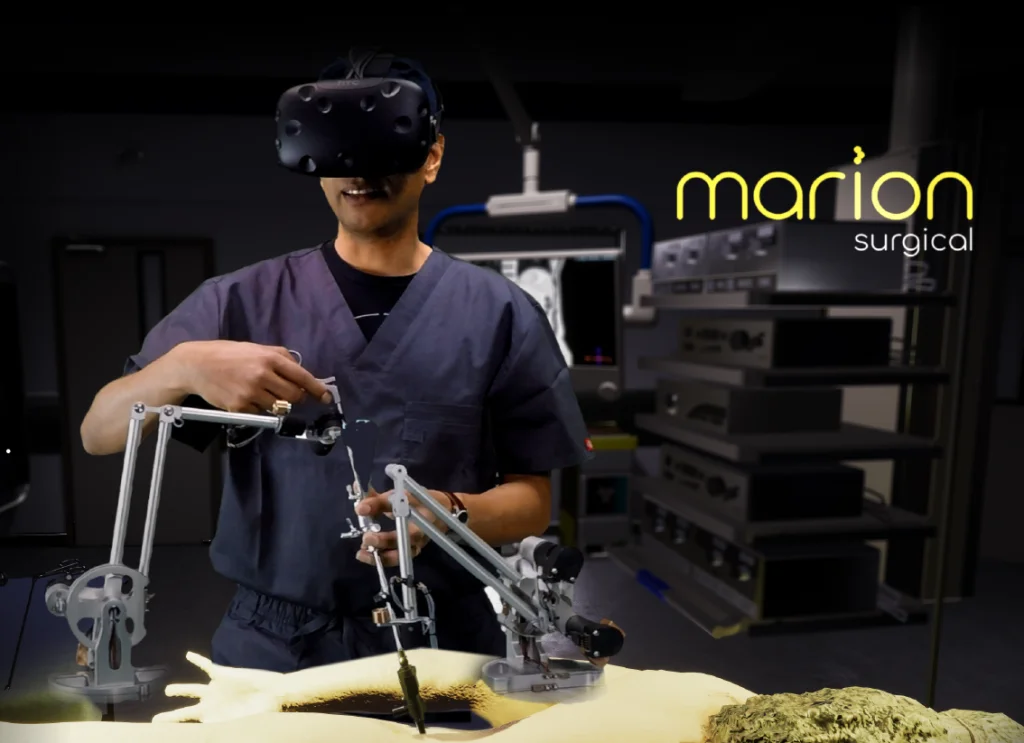 SOLIDWORKS Entrepreneur Marion Surgical Virtually Removes Kidney Stone