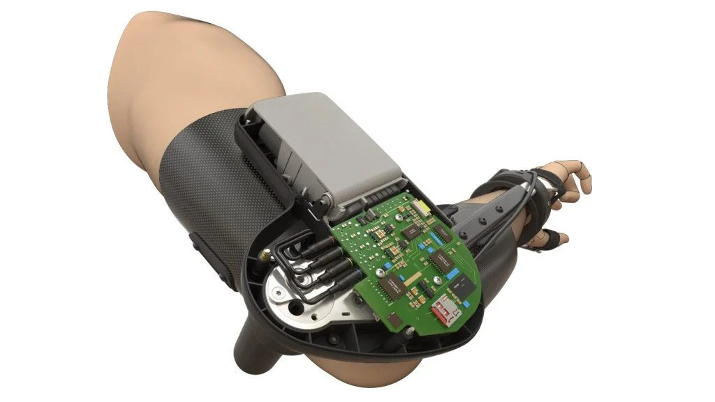 Hardware Startup Myomo Partners with SOLIDWORKS for Success